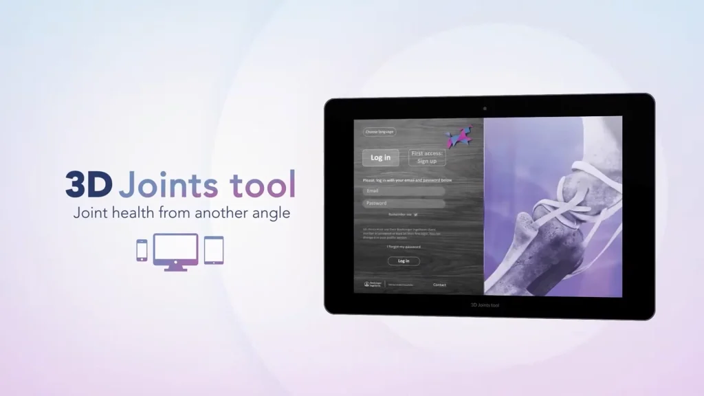 Un gemelo digital de la articulación